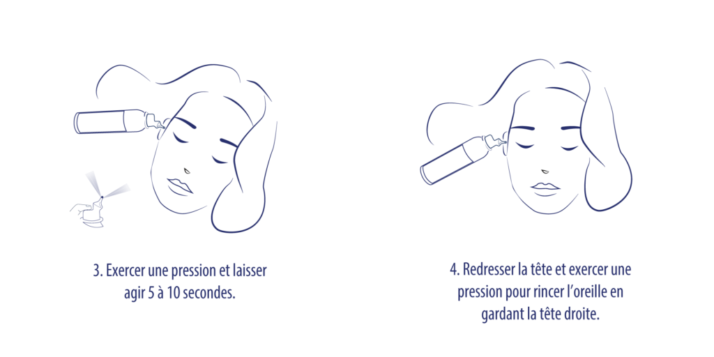 illustration utilisation cerumen 2