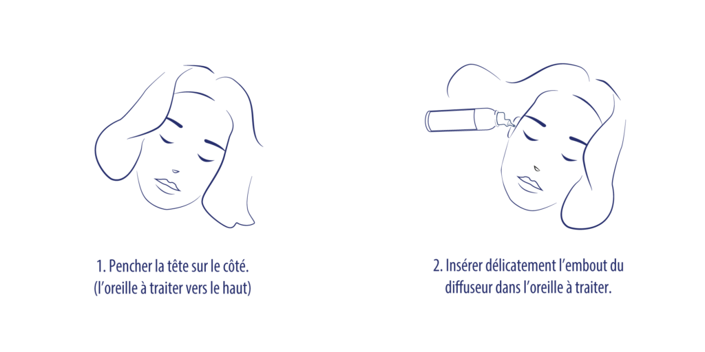 illustration utilisation cerumen 1